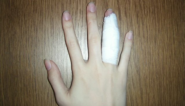 指が内出血する原因と処置方法 トリビアーノ